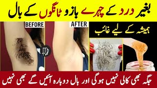 Remove Unwanted Facial Hair At Home  Permanent Hair Removal Home Remedy  Painless Hair Removal [upl. by Christalle206]