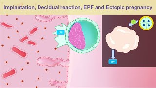 Implantation Decidual reaction EPF and Ectopic pregnancy [upl. by Elad]