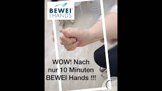 Arthrose Sie konnte die Finger kaum bewegen  dann probierte sie 10 Min BEWEI Hands  WOW [upl. by Bloxberg]