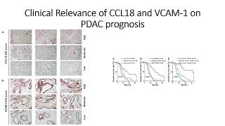 Clinical Relevance of VCAM1 and CCL18 on Pancreatic Cancer PDAC prognosis Code 671 [upl. by Analli]