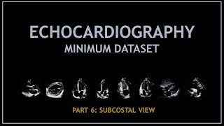 Echocardiogram Minimum dataset PART 6 Subcostal view [upl. by Fayre546]