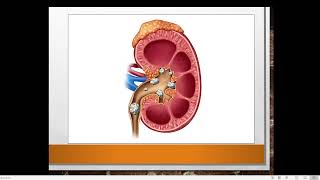 Peritoneal and haemodialysis [upl. by Honorine]