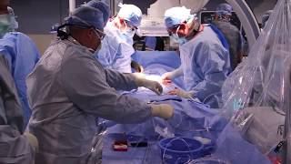 Watch a Transcatheter Aortic Valve Replacement TAVR Procedure at St Lukes in Cedar Rapids Iowa [upl. by Aligna263]