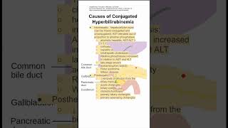 Causes of Conjugated Hyperbilirubinemia [upl. by Yvonne]