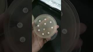 lawn culture antibiotic sensitivity test medical medico microbiology [upl. by Eugine]