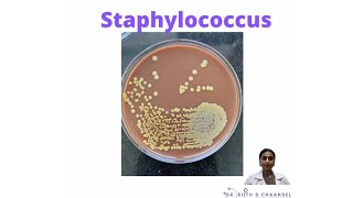 Things to know about Staphylococcus [upl. by Joerg987]