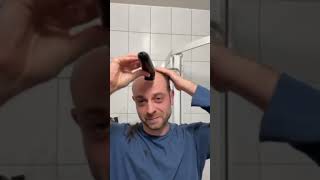 Balding Man Shocked By EPIC Transformation [upl. by Corron258]