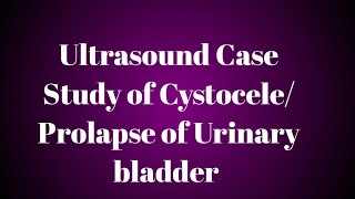 Ultrasound Case Study of CystoceleProlapse of Urinary bladder [upl. by Hatcher]