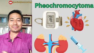 Pheochromocytoma  Cause Symptoms And Treatment  medicalpharmacology mbbs [upl. by Adaner]