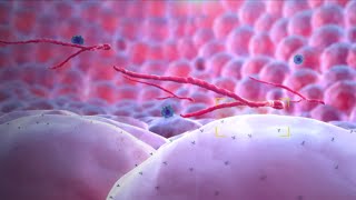 Ebola Virus  Mechanism of Action  3D Medical Animation [upl. by Beau]