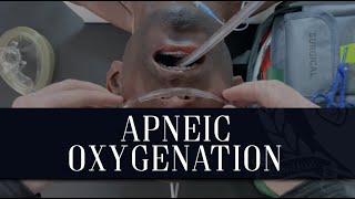 ApOx  Apneic Oxygenation [upl. by Geithner]