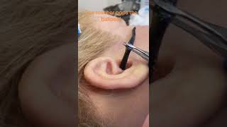 How to Remove worms inside the ear [upl. by Airdnoed]