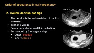 Ultrasound of normal early pregnancy [upl. by Aynna39]