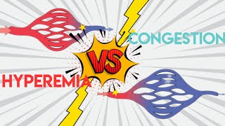 Mnemonics Hyperemia Vs Congestion Pathology  Acute Inflammation [upl. by Arodnap]