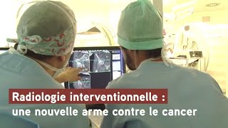 La radiologie interventionnelle une nouvelle arme contre cancer [upl. by Kepner]