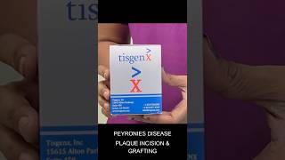 Peyronie’s disease treatment  plaque incision with grafting peyroniesdisease [upl. by Lamek]