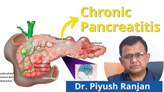 😣 Chronic Pancreatitis Causes Symptoms Diagnosis and Treatment in Hindi [upl. by Sekoorb]