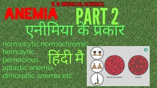 Anemia amp its types simple एक्सप्लनेशन हिंदी ANEMIA PART 2 [upl. by Idieh775]