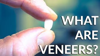 DENTAL VENEERS  WHAT THE HECK ARE THEY COSMETIC DENTISTRY [upl. by Camarata]