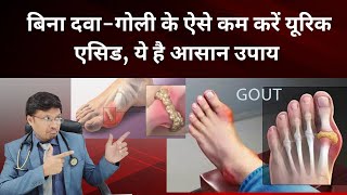 BEST TIPS TO REDUCE URIC ACID IN GOUT PATIENTS [upl. by Yssac649]