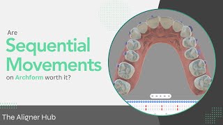 Sequential Movements on Archform [upl. by Ilak]