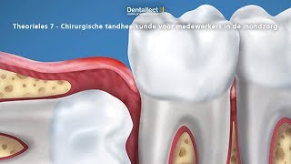 Theorieles 7  Chirurgische tandheelkunde voor medewerkers in de mondzorg [upl. by Eltsyrk]