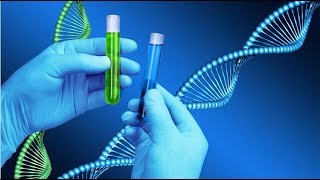 Anti Double Strand DNA Test [upl. by Middleton]