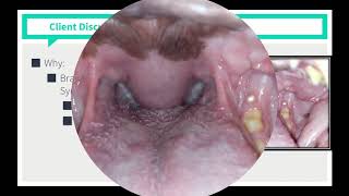 VICE Rounds  Brachycephalic Airway Syndrome See Description For How to Access More Videos [upl. by Adnav]