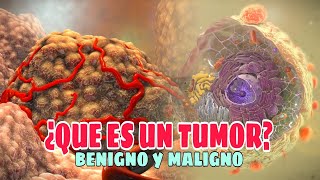 ✅Qué es un TUMOR Tipos Causas Síntomas Tratamiento✅ [upl. by Arthur829]