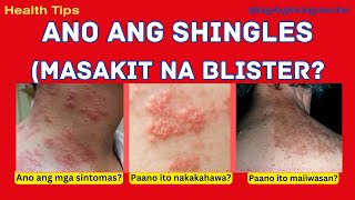 Shingles Masakit na blisters Signs amp Symptoms  Health Tips 7 Tagalog [upl. by Aisul]