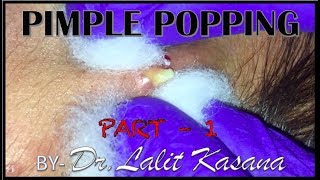 PIMPLE POPPING PART 1 [upl. by Eicaj]