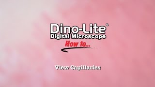 How to View Capillaries using DinoLite USB Microscopes [upl. by Nytnerb643]