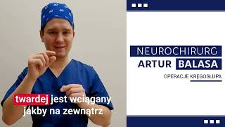 Co to jest przepuklina rdzenia kręgowego neurochirurg kręgosłup [upl. by Anertal213]