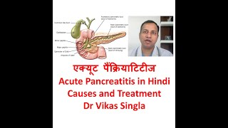 Acute Pancreatitis Treatment and Causes in Hindi By Dr Vikas Singla Max Hospital New Delhi [upl. by Anelahs]