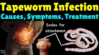 Tapeworm Infection Symptoms Causes Life Cycle Diagnosis Treatments Complications amp Prevention [upl. by Pontus]