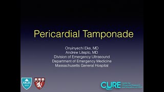 Pericardial Tamponade [upl. by Gurevich]