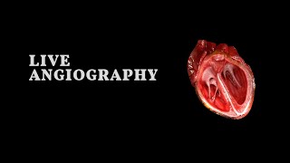 Real Heart Angiography Video Different Angles [upl. by Atnas59]