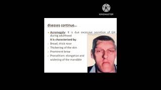 Acromegaly physiotherapy physiology youtube shorts [upl. by Wertheimer]