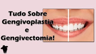 Aula de Periodontia  Tudo Sobre Gengivoplastia e Gengivectomia  Indicações e Passo a Passo [upl. by Crawford]