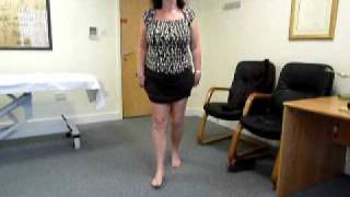 Patient walking 5 months after High Tibial Osteotomy HTO Surgery [upl. by Marvel630]