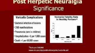 Pain Didactic Herpes Zoster and PHN  Pt 3 [upl. by Darej]