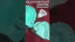 Landmarks on tooth surfaces  LINGUAL FOSSA  Short video LINK IN DESCRIPTION  Dental Anatomy [upl. by Loginov]