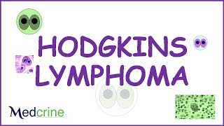 Hodgkins Lymphoma Pathophysiology symptoms and treatment [upl. by Stormy]