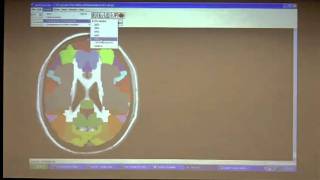 VLSM Mini course Session 2 2 of 7 [upl. by Adnav]