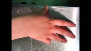 Lateralization Practice  Southlake Hand Therapy [upl. by Aiouqes761]