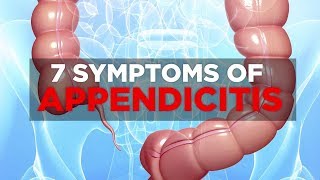 7 Symptoms of Appendicitis  Health [upl. by Atinus]