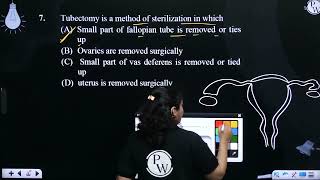 Tubectomy is a method of sterilization in whichampnbsp [upl. by Yursa817]