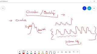 Types of PulsePulsus Paradoxus Pulsus Alternans Anacrotic Waterhammer pulse [upl. by Oiludbo]