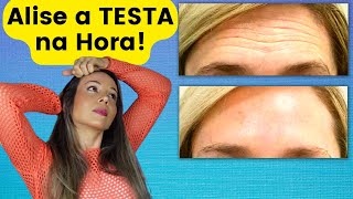 Como TIRAR as RUGAS da Testa SEM USAR BOTOX [upl. by Crawley]