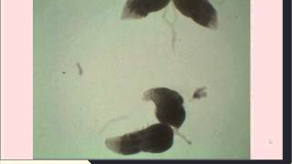 Drosophila Ovarian Dissection for Immunohistochemistry [upl. by Jolee692]